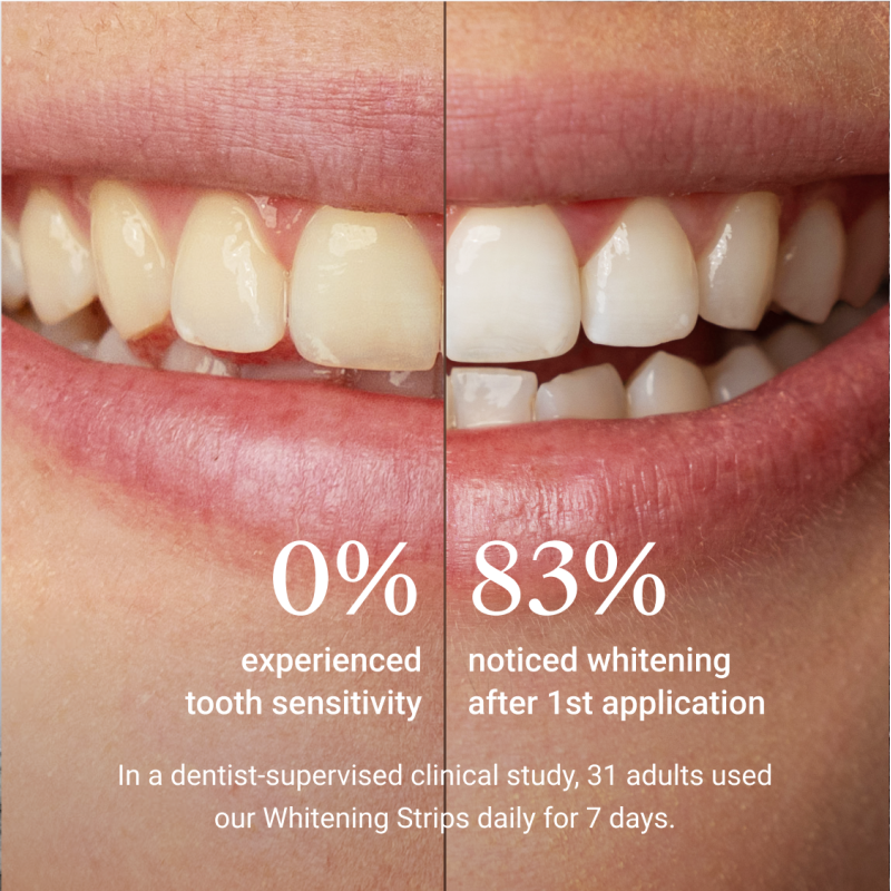 Whitening Strips Sensitive Balinošās zobu strēmeles jutīgiem zobiem, 7 pāri