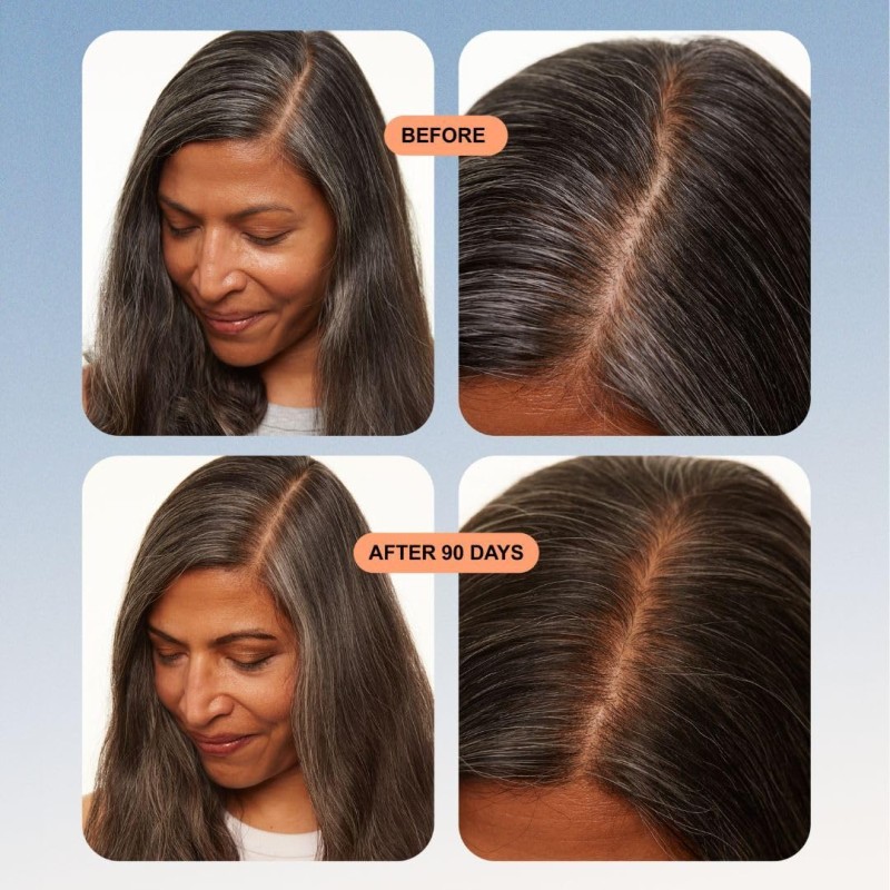 Saisei Biomimetic Peptide Treatment Essence Atjaunojošs matu serums ar peptīdiem, 50 ml