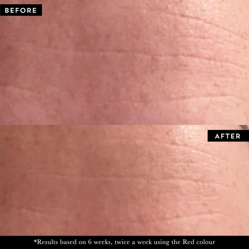 PHOTON LED Light Therapy Face Mask LED sejas maska, 1 gab.